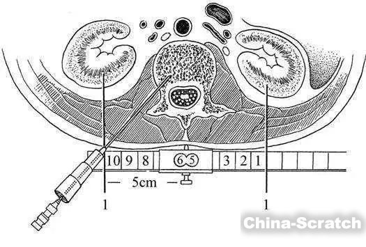https://www.china-scratch.com/Uploads/timg/190911/120J34K2-8.jpg